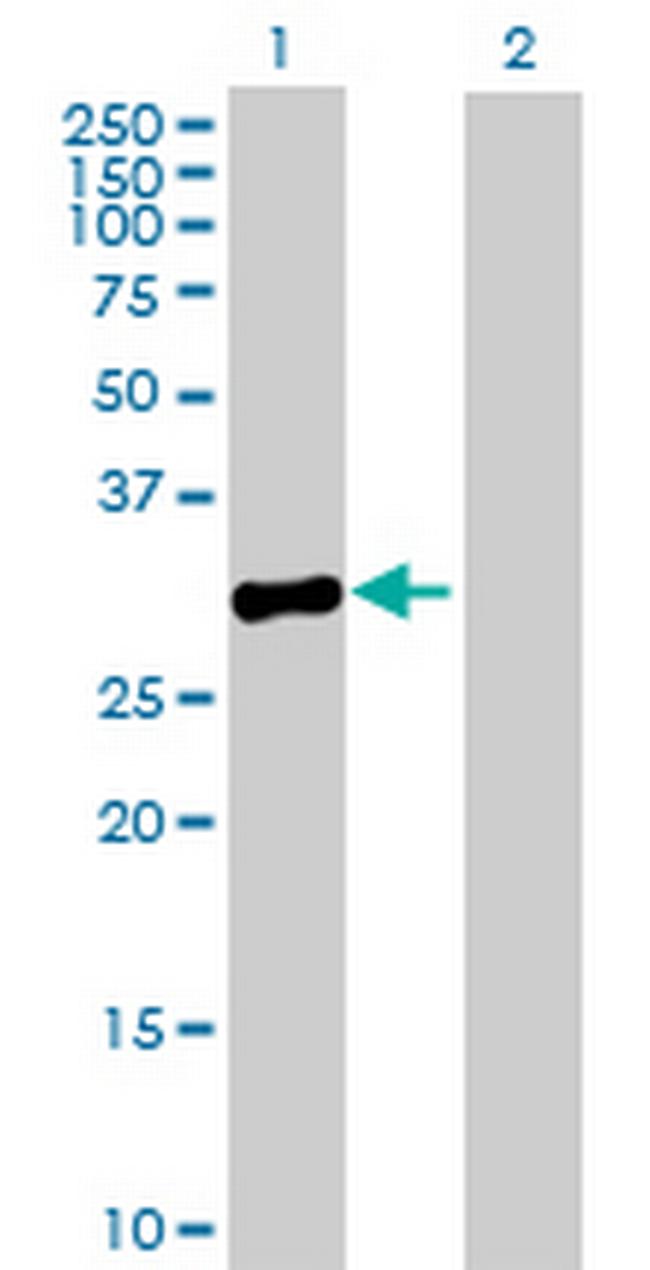 MPPED2 Antibody in Western Blot (WB)