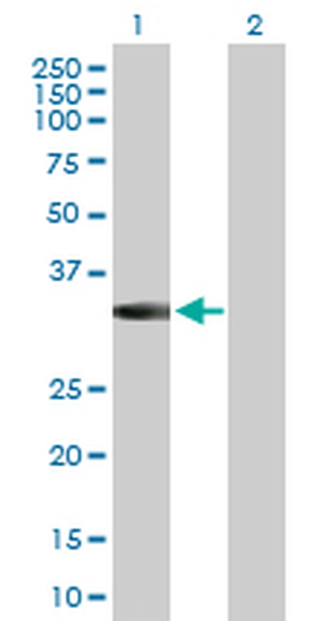 MPPED2 Antibody in Western Blot (WB)