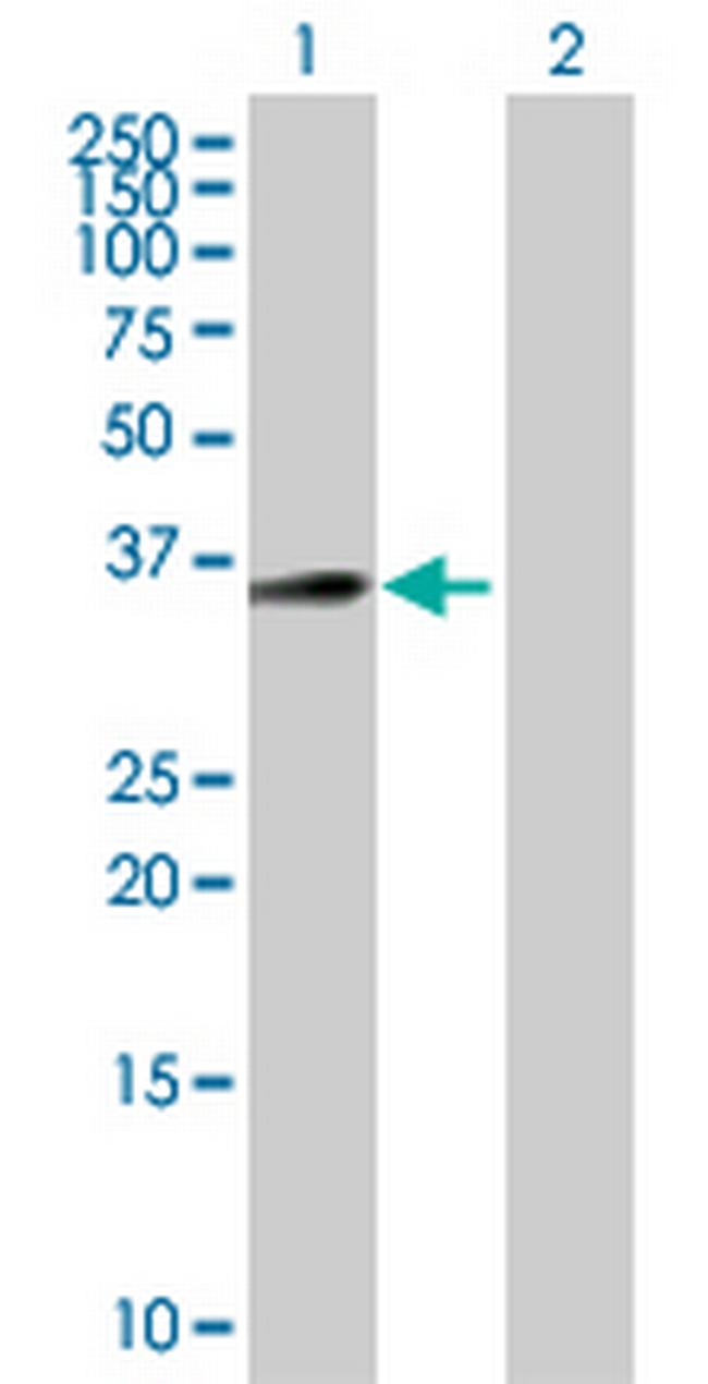 C18orf1 Antibody in Western Blot (WB)