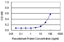 C21ORF2 Antibody in ELISA (ELISA)