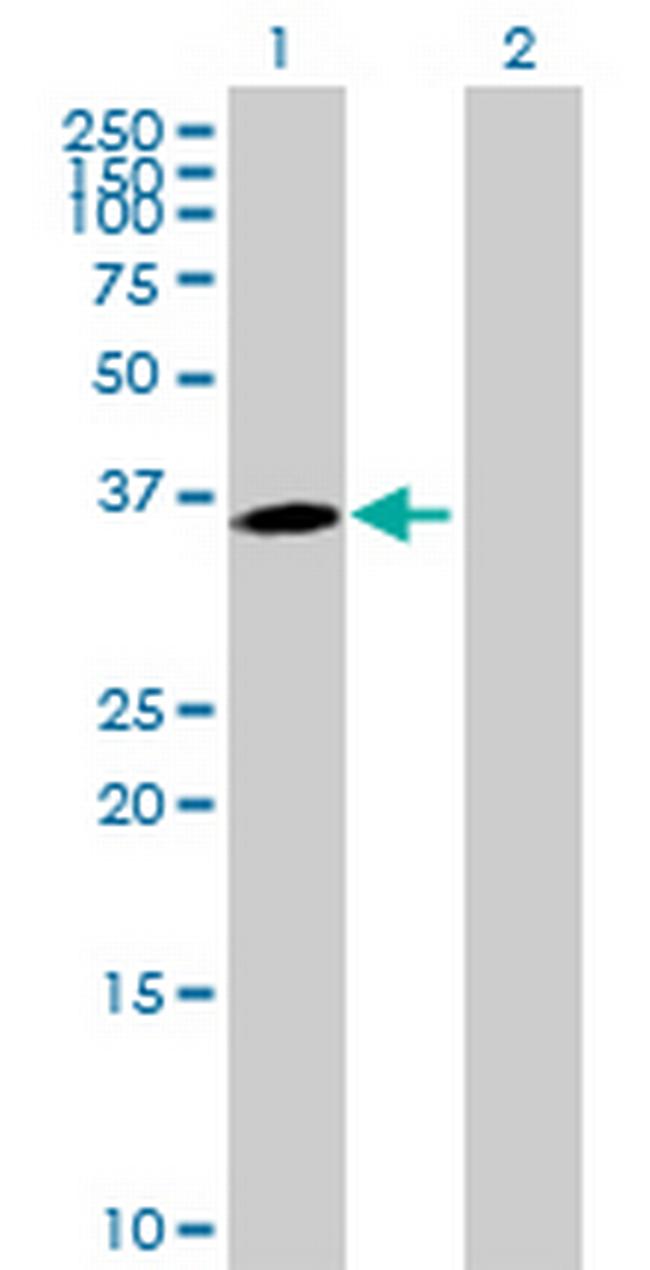 MPPED1 Antibody in Western Blot (WB)