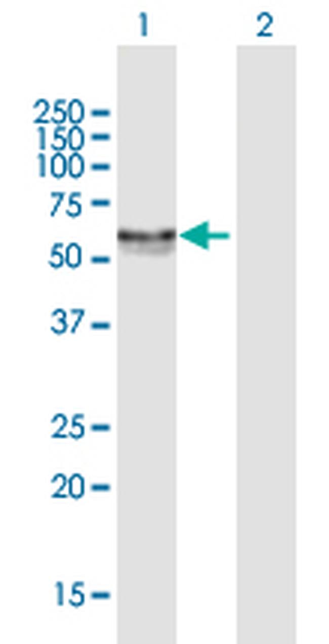 CA9 Antibody in Western Blot (WB)