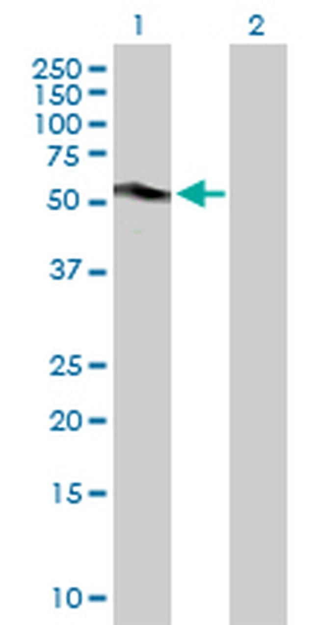CA9 Antibody in Western Blot (WB)