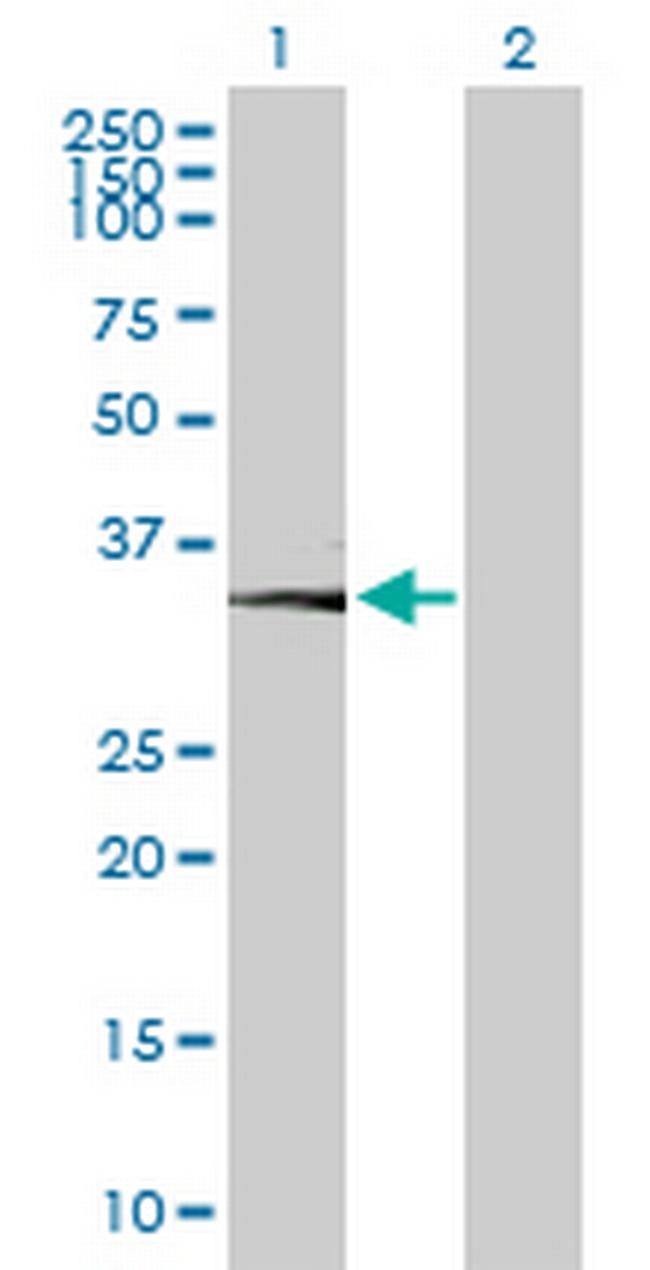 CA11 Antibody in Western Blot (WB)