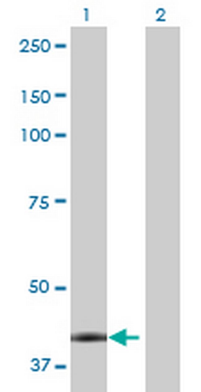 CA12 Antibody in Western Blot (WB)