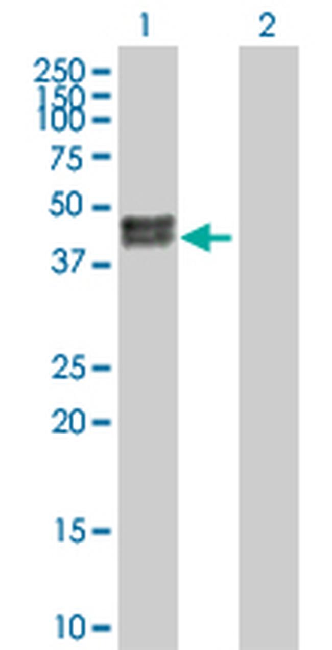 CA12 Antibody in Western Blot (WB)