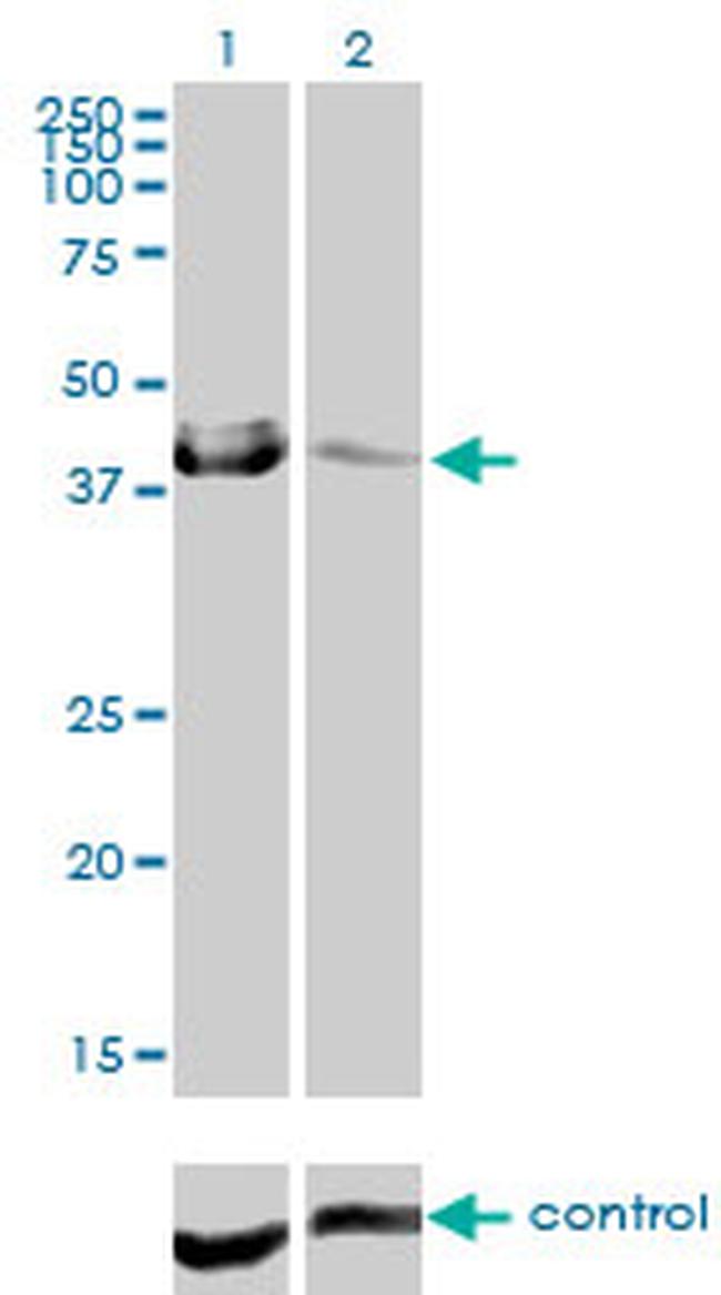 CA12 Antibody in Western Blot (WB)