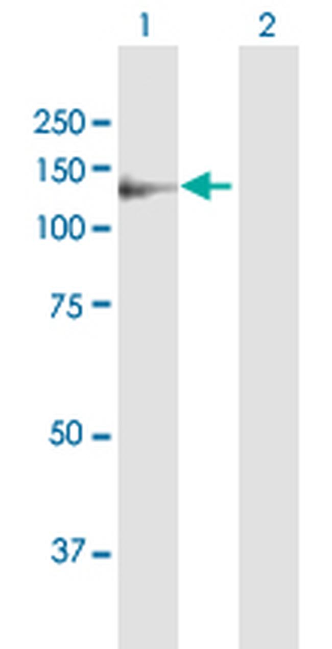 DDR1 Antibody in Western Blot (WB)