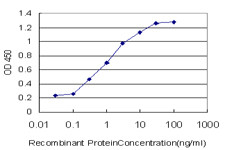 CACNB2 Antibody in ELISA (ELISA)