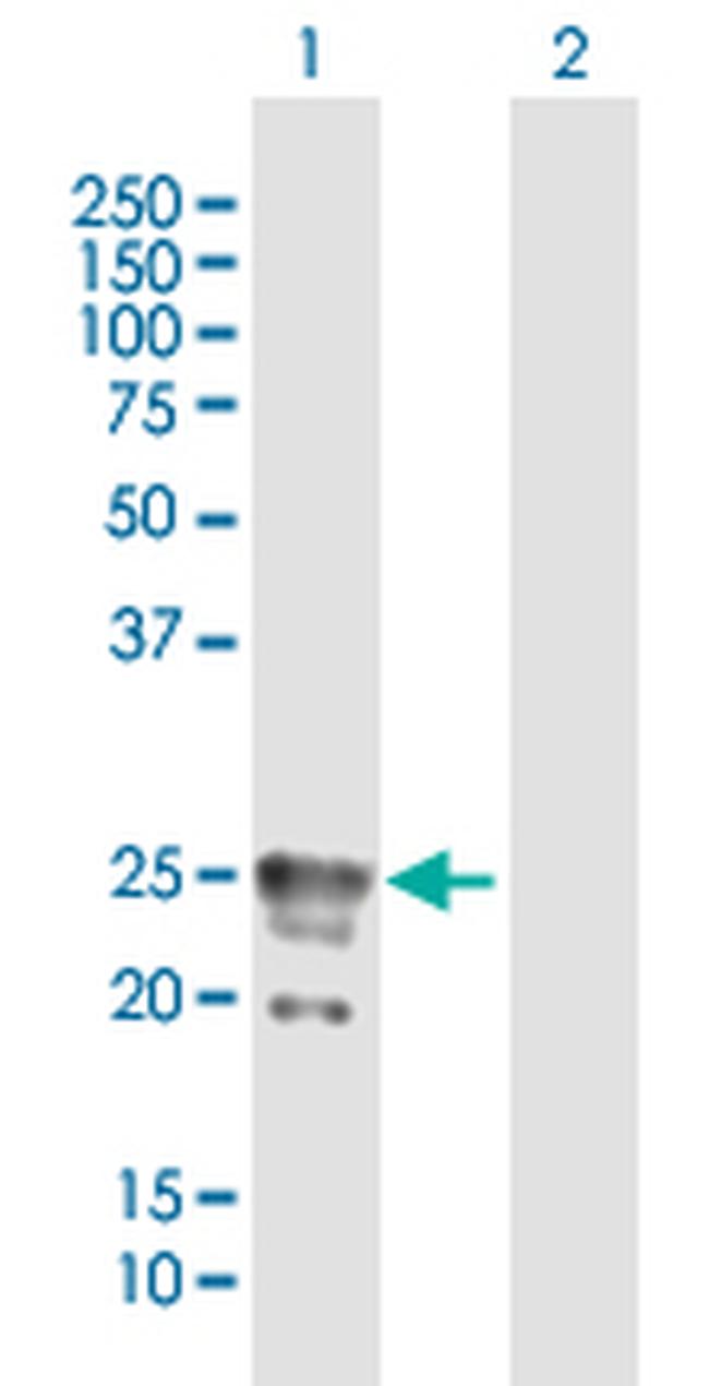 CACNG1 Antibody in Western Blot (WB)