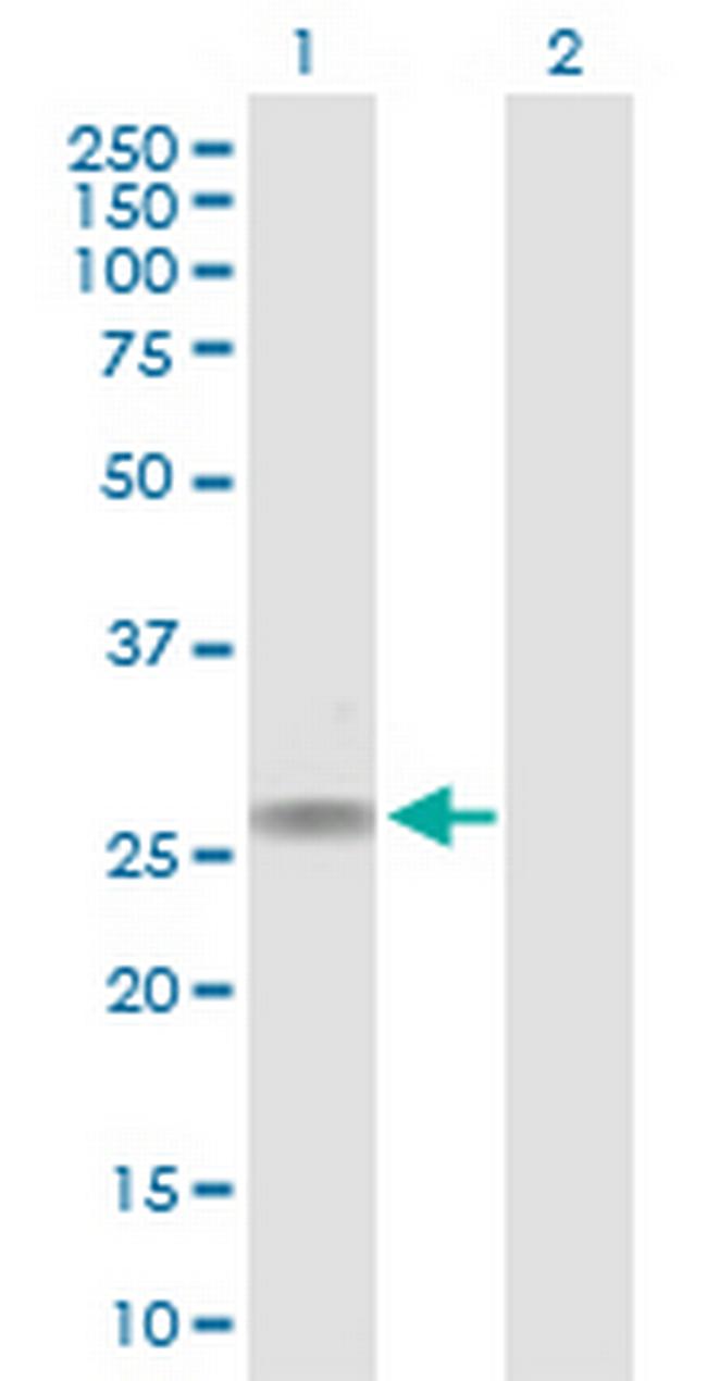 CACNG1 Antibody in Western Blot (WB)