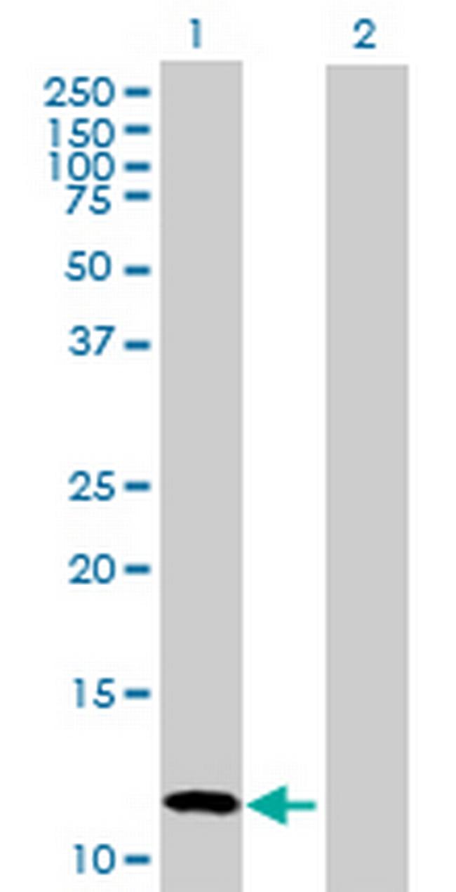 CALCB Antibody in Western Blot (WB)
