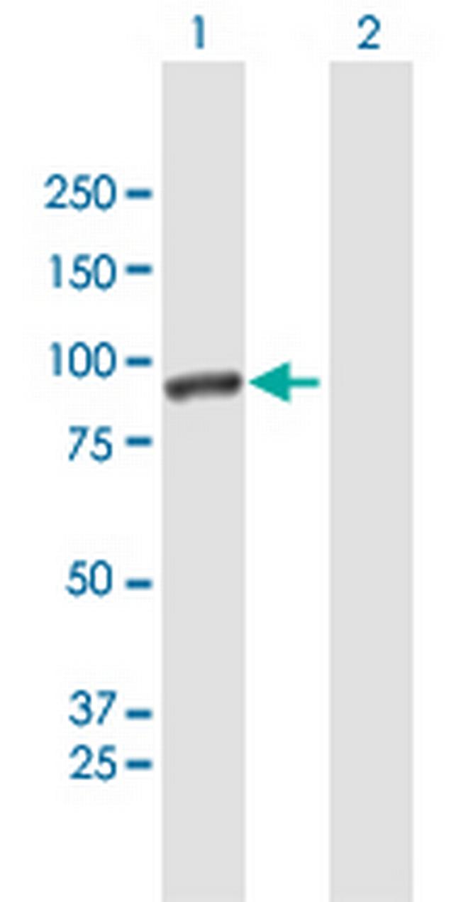CALD1 Antibody in Western Blot (WB)