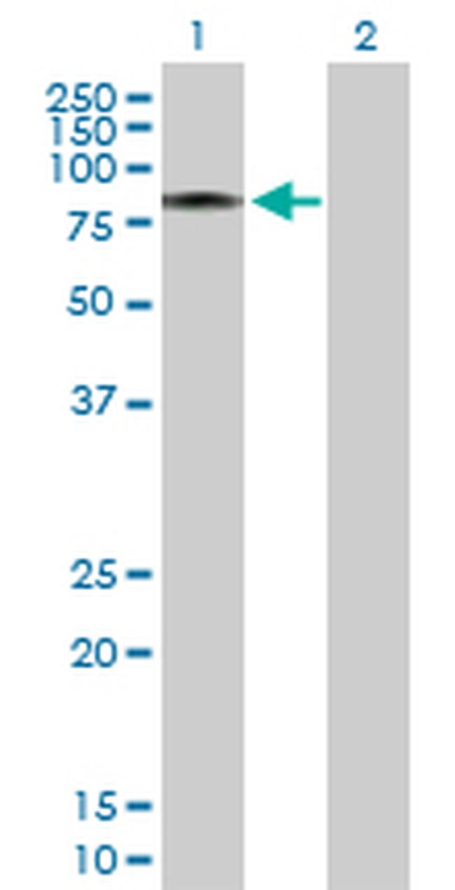 CALD1 Antibody in Western Blot (WB)