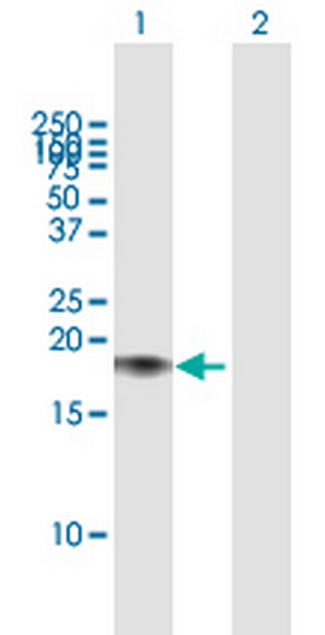 CALM2 Antibody in Western Blot (WB)