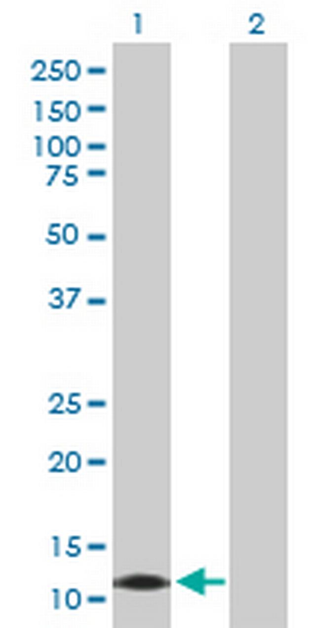 CALML3 Antibody in Western Blot (WB)
