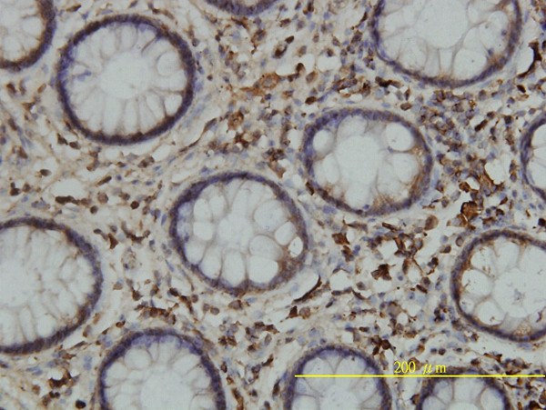 CALR Antibody in Immunohistochemistry (Paraffin) (IHC (P))