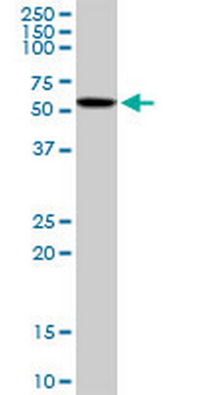 CAMK4 Antibody in Western Blot (WB)