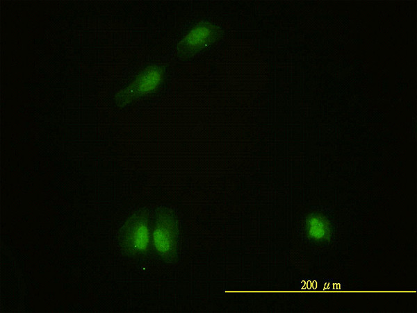 CAMK4 Antibody in Immunocytochemistry (ICC/IF)