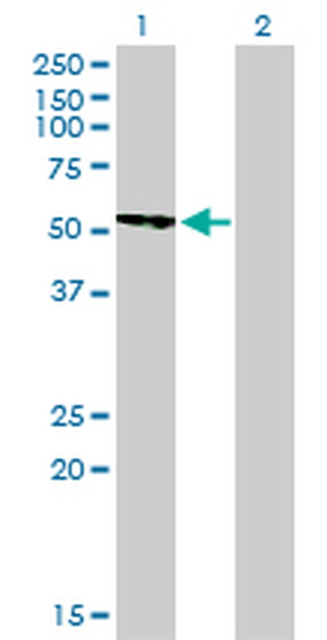 CAMK2B Antibody in Western Blot (WB)