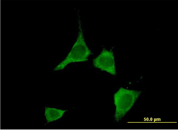 CAMK2D Antibody in Immunocytochemistry (ICC/IF)