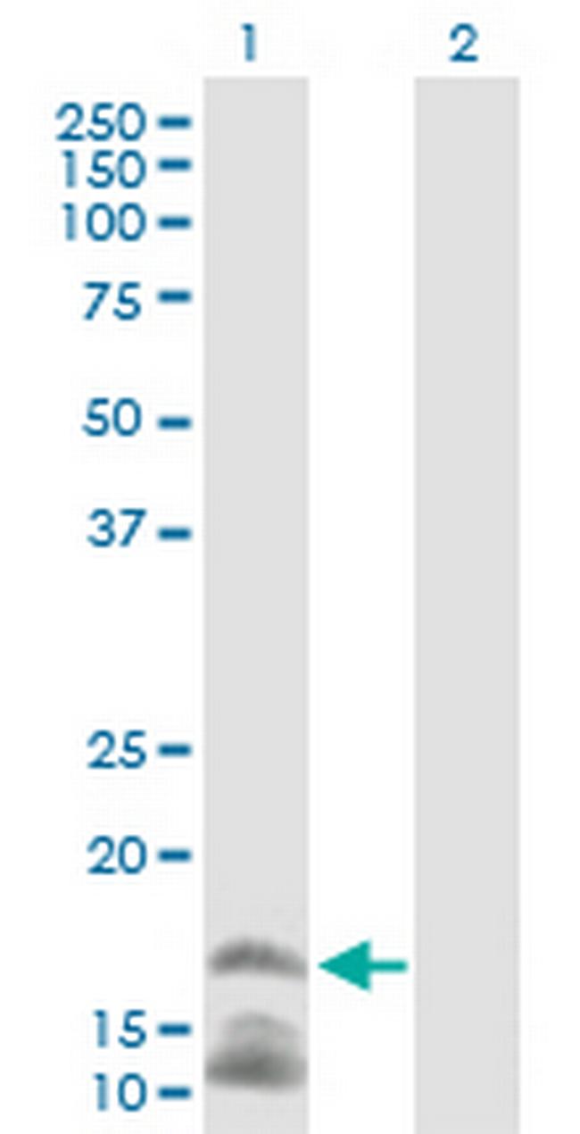 CAMP Antibody in Western Blot (WB)