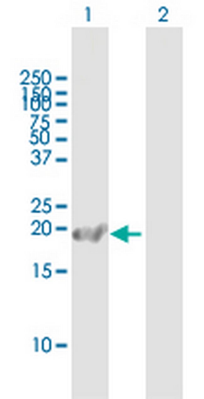 CAPS Antibody in Western Blot (WB)