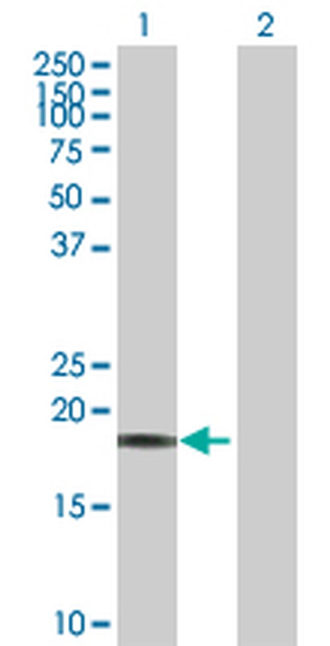 CAPS Antibody in Western Blot (WB)