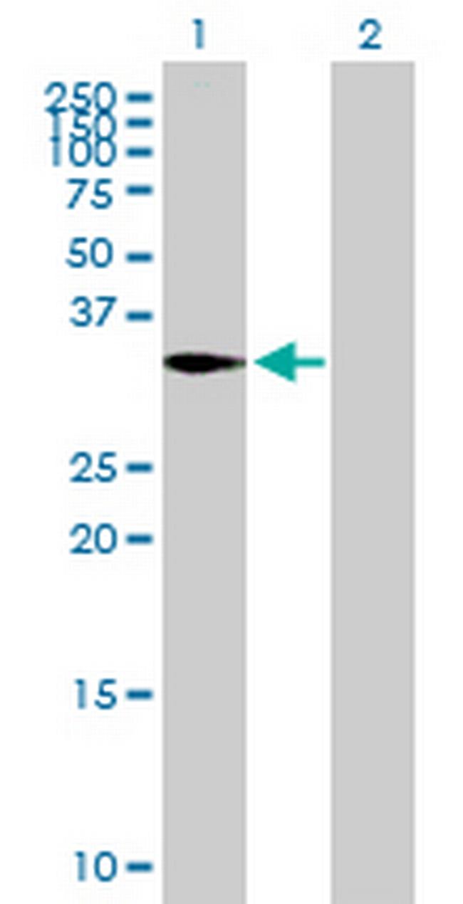 CAPZA2 Antibody in Western Blot (WB)