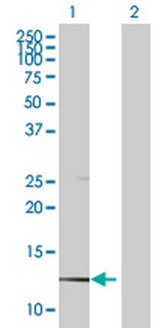 CAPZB Antibody in Western Blot (WB)