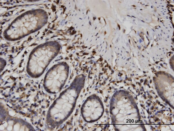 CAPZB Antibody in Immunohistochemistry (Paraffin) (IHC (P))