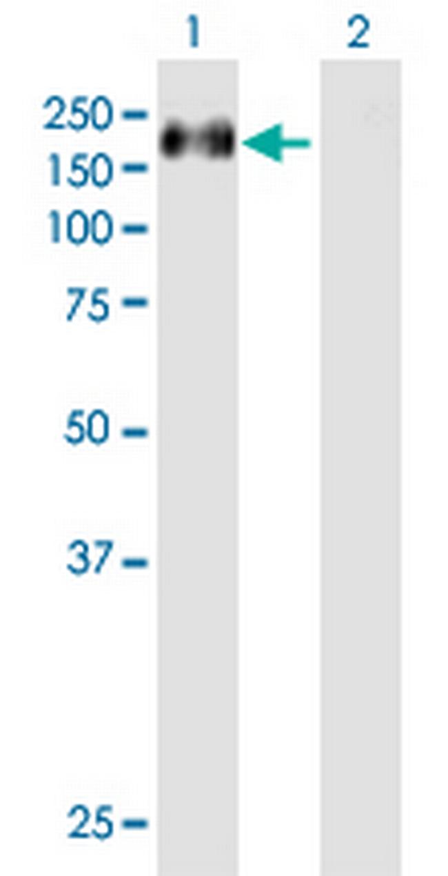 CASR Antibody in Western Blot (WB)