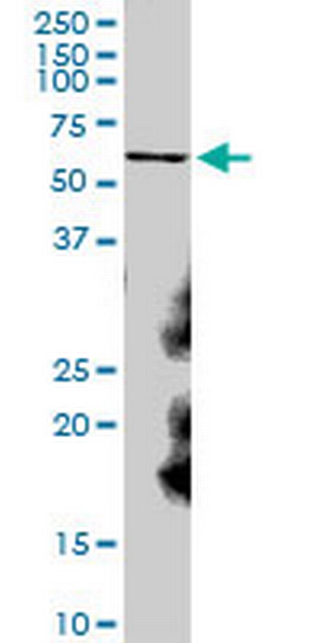 CAT Antibody in Western Blot (WB)