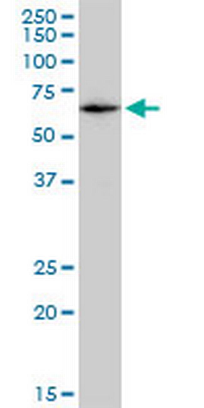 CAT Antibody in Western Blot (WB)