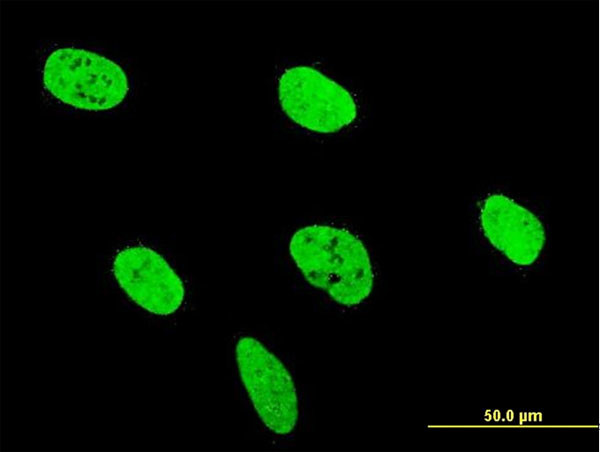 RUNX2 Antibody in Immunocytochemistry (ICC/IF)