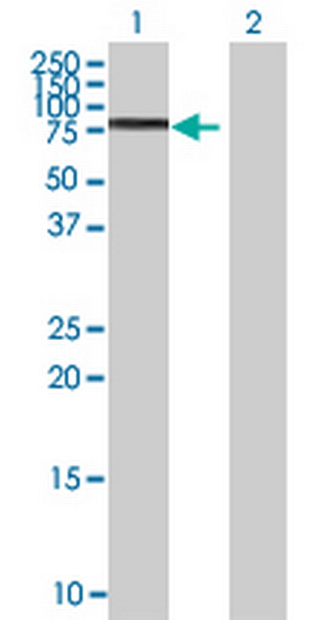 RUNX1T1 Antibody in Western Blot (WB)