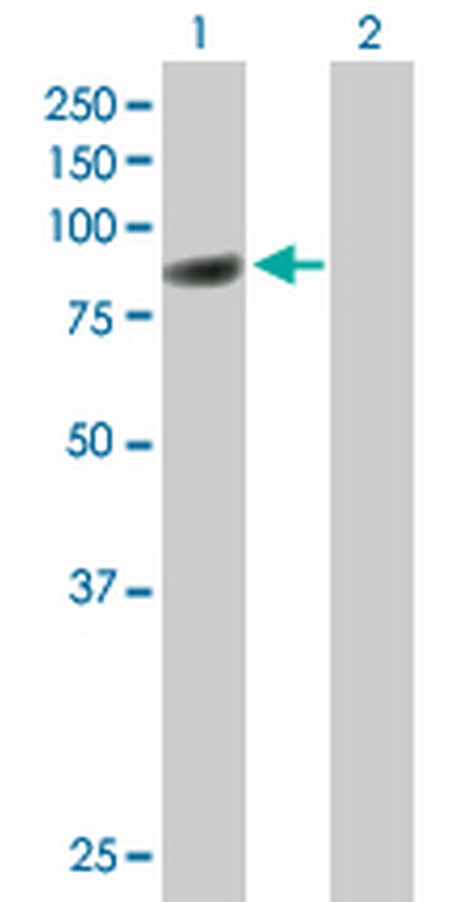 CBFA2T3 Antibody in Western Blot (WB)