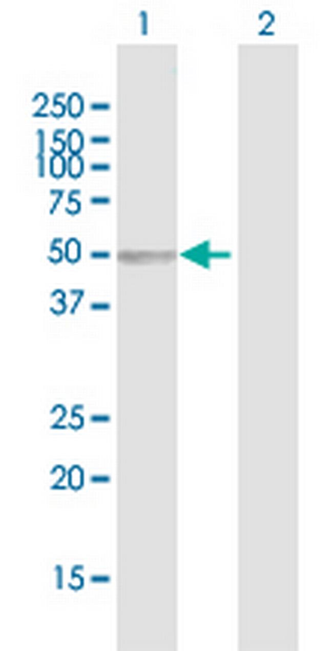 SERPINA6 Antibody in Western Blot (WB)