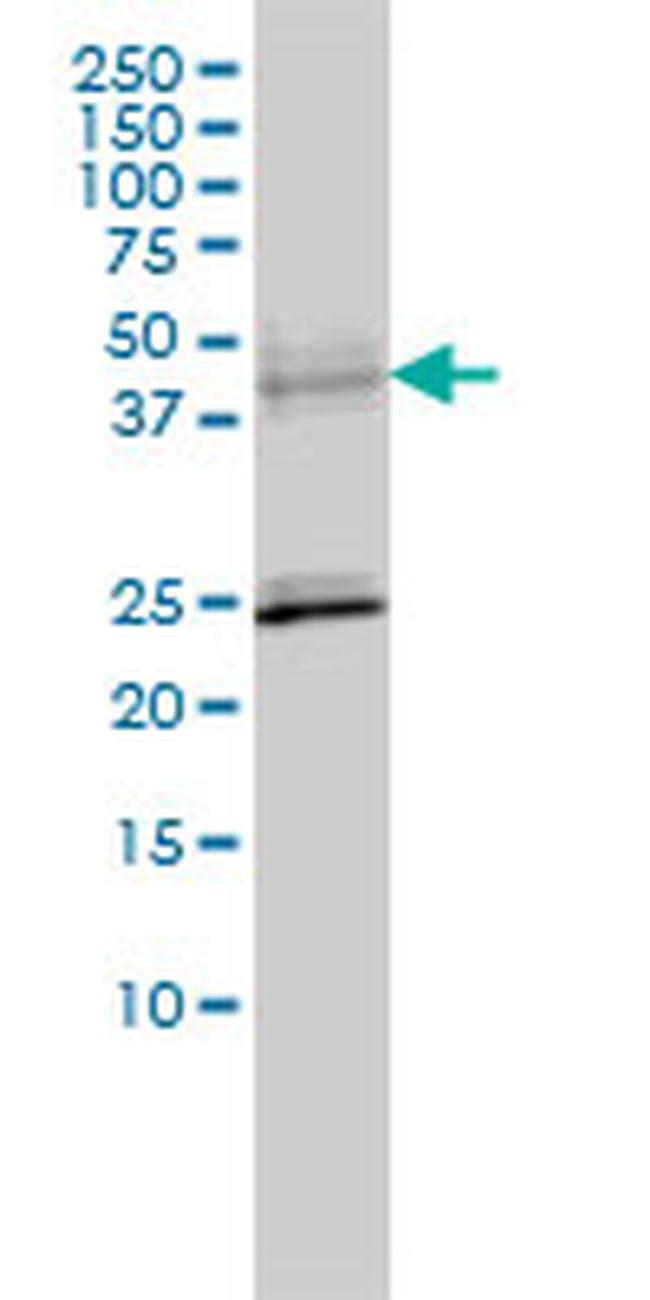 SERPINA6 Antibody in Western Blot (WB)
