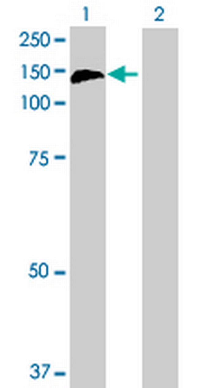 CBL Antibody in Western Blot (WB)