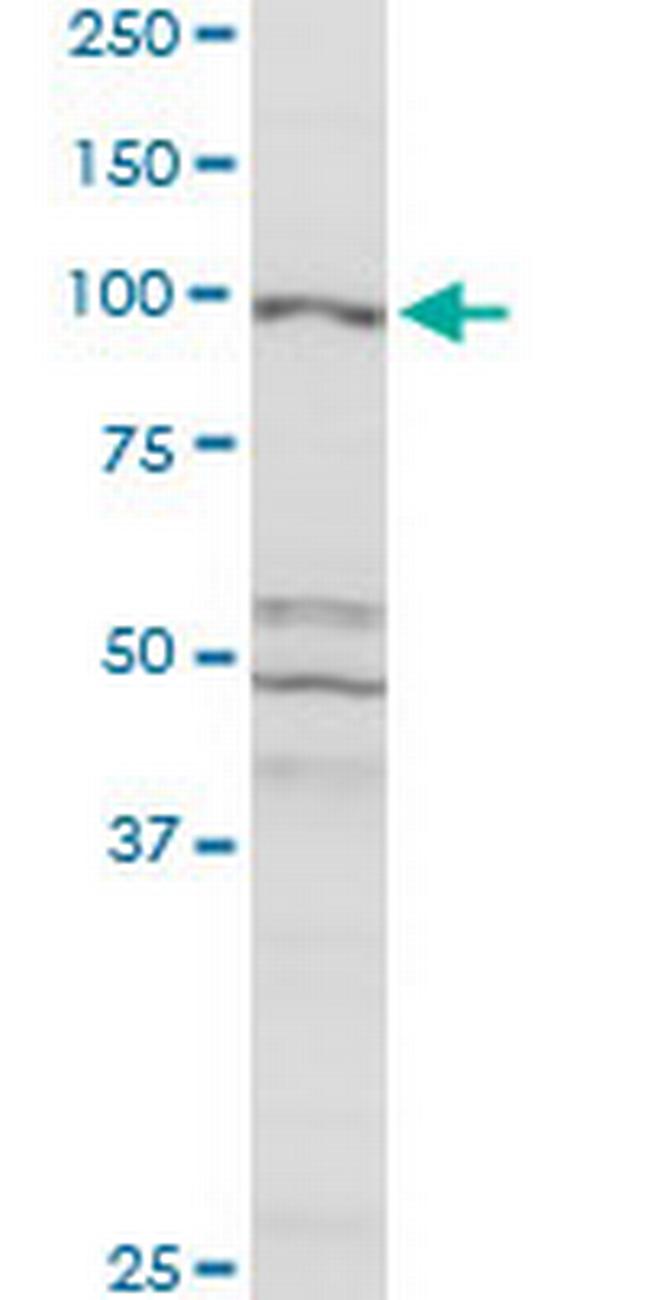 CBL Antibody in Western Blot (WB)