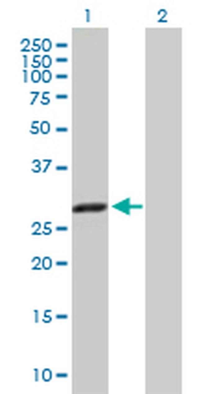 CBR1 Antibody in Western Blot (WB)