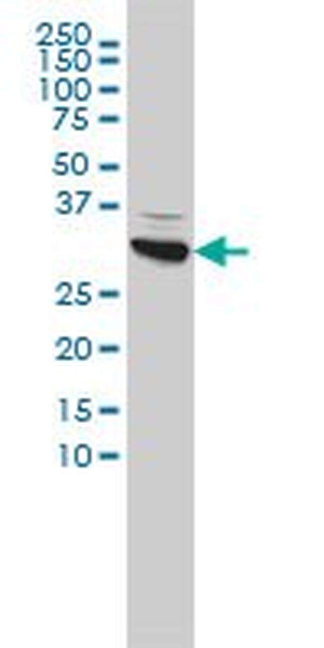CBR1 Antibody in Western Blot (WB)