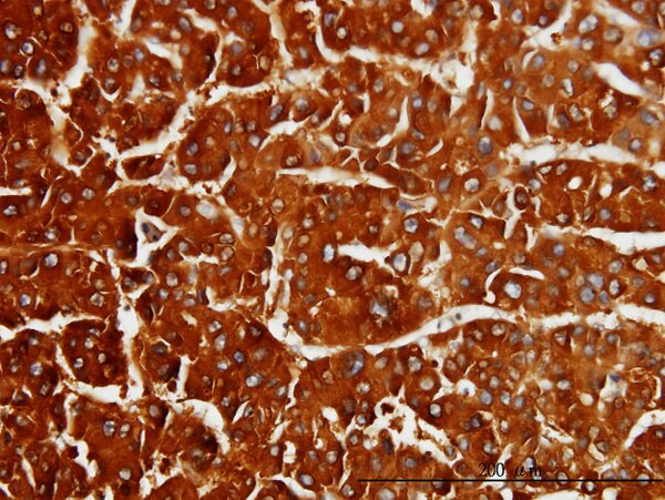CBS Antibody in Immunohistochemistry (Paraffin) (IHC (P))