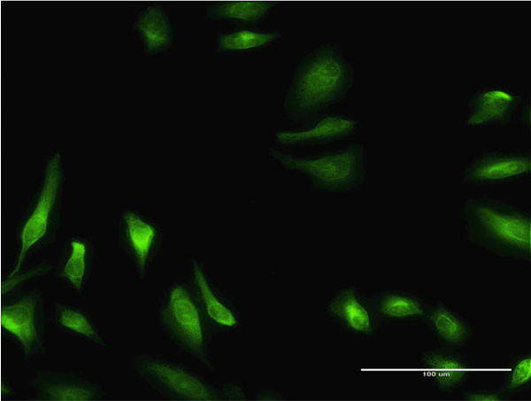 CBS Antibody in Immunocytochemistry (ICC/IF)
