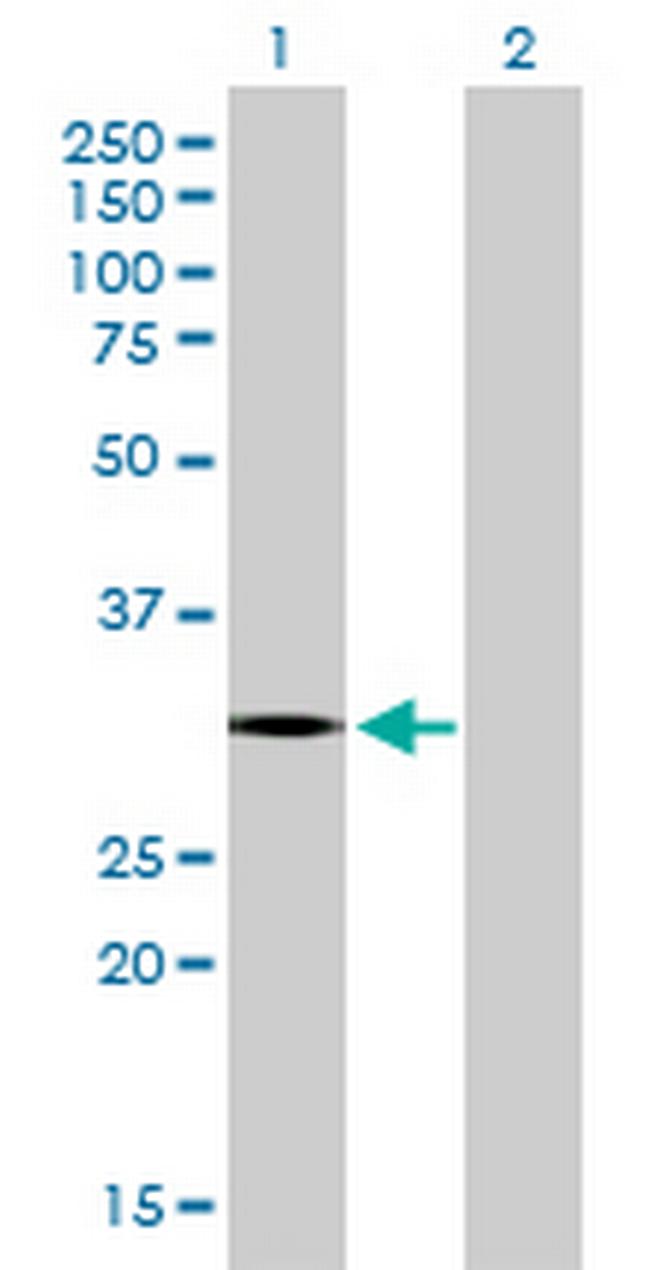CCNC Antibody in Western Blot (WB)