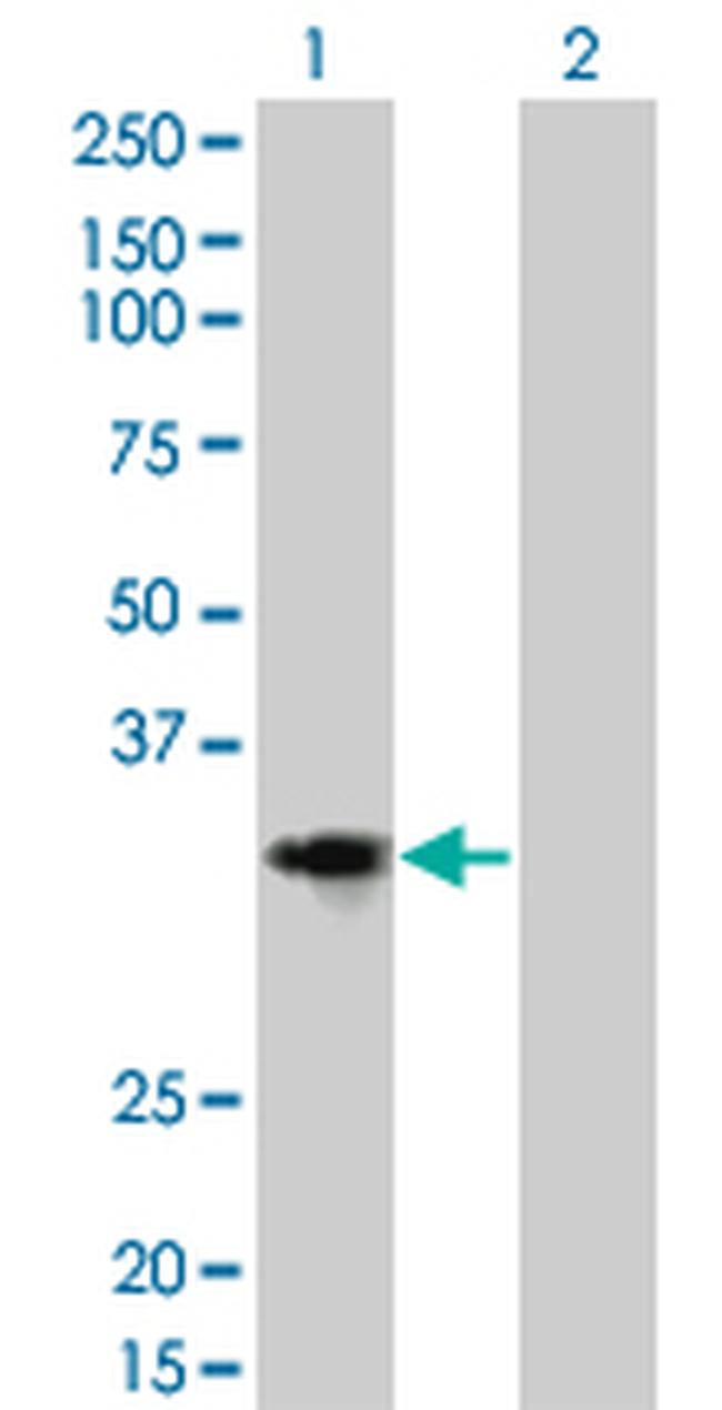 CCND2 Antibody in Western Blot (WB)