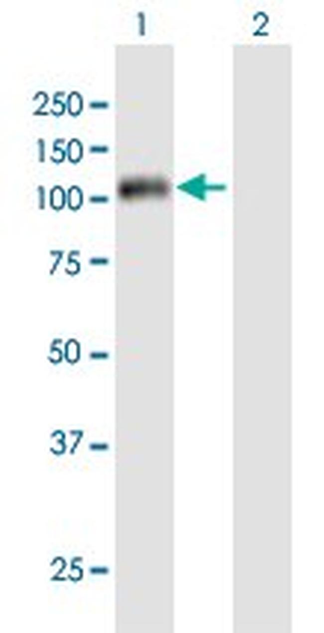 CCNF Antibody in Western Blot (WB)