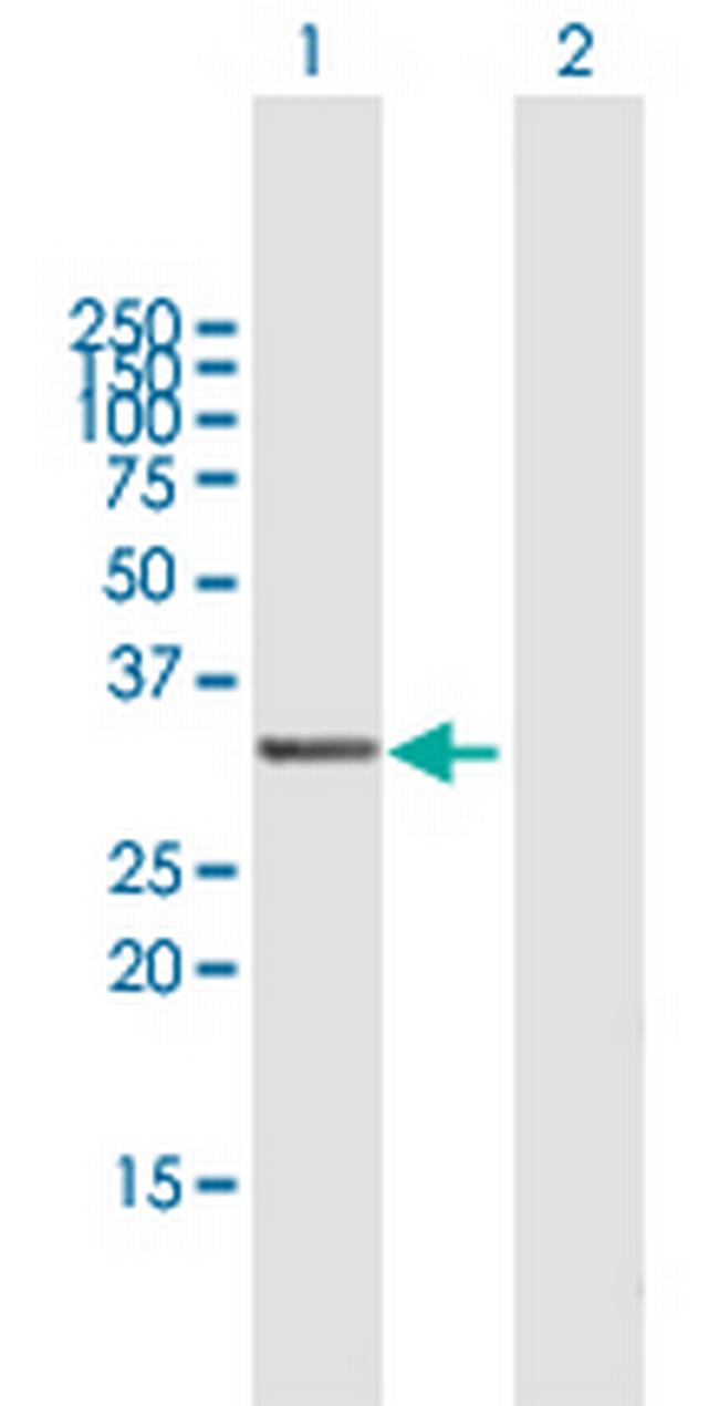 CD1A Antibody in Western Blot (WB)