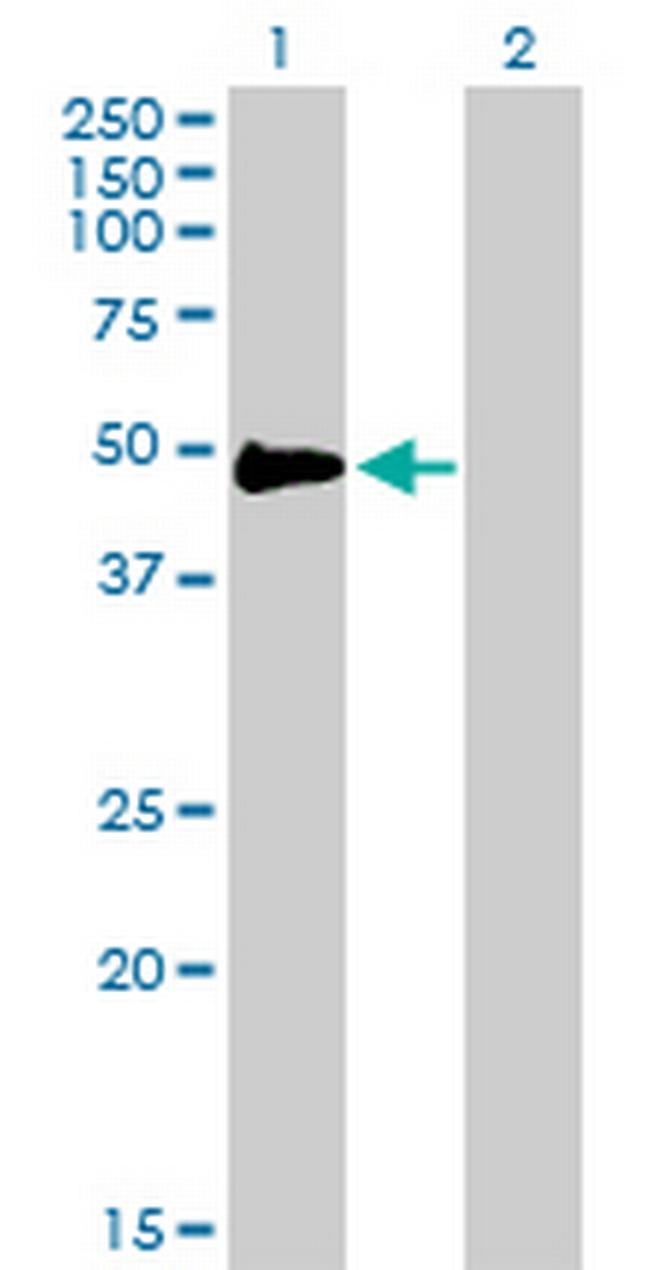 CD2 Antibody in Western Blot (WB)